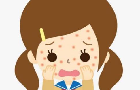 麻疹是怎样传播的?什么是麻疹?